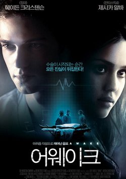 Anestezi(Awake) Filmi 

İzle